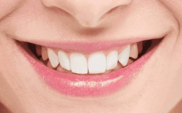 Dental Implants in Tirupur