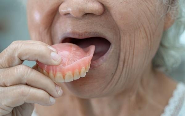 Dentures in Tirupur